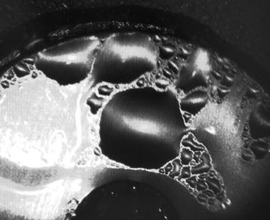 Envirocam Picture of Condensation #1